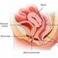 Illness of the cervix and methods of treatment